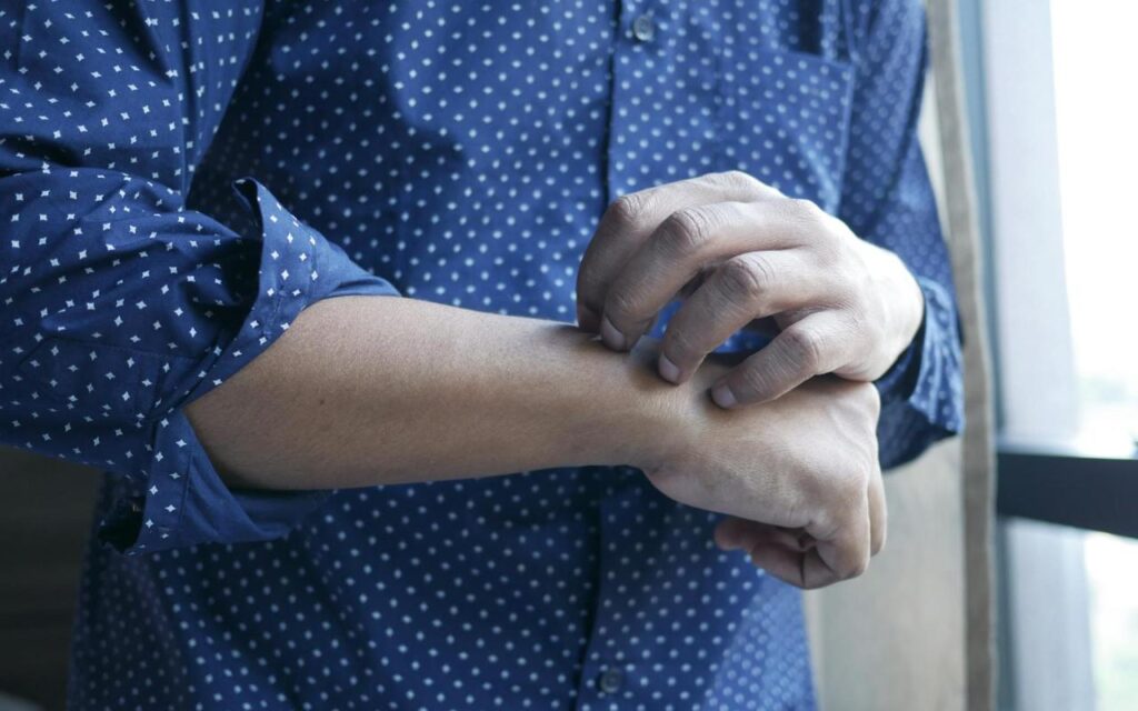 Первая медицинская помощь при укусах насекомых