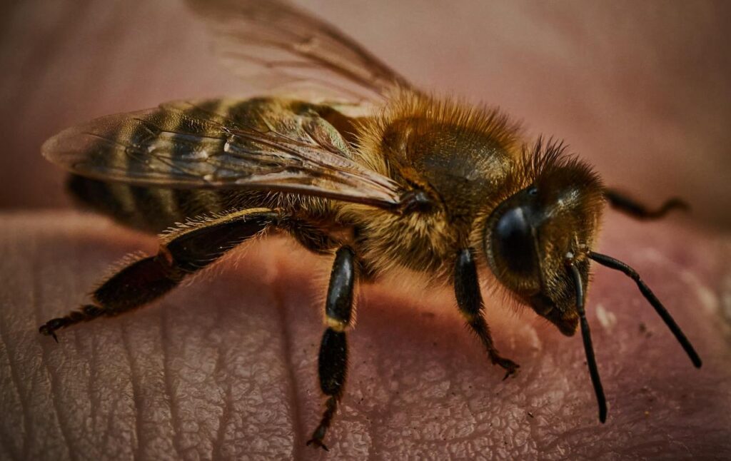 Первая помощь при укусе пчелы до приезда скорой