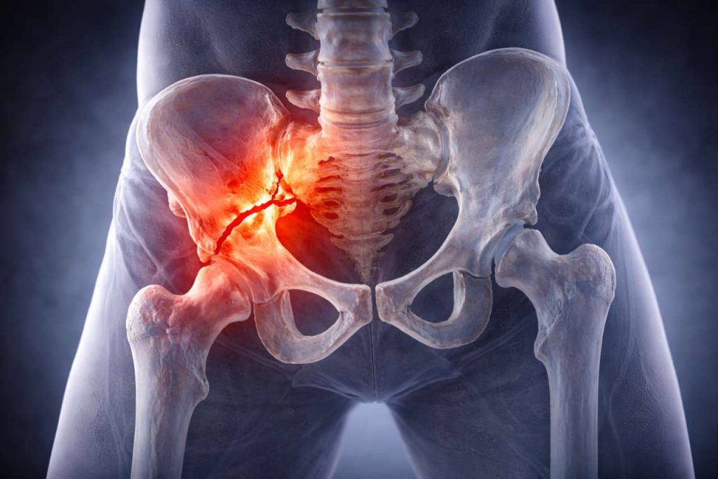 Первая помощь при травмах таза